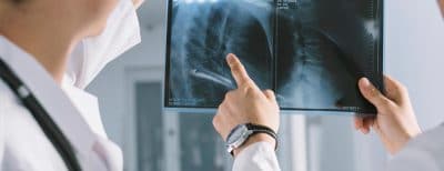 Doctors Examing X-Rays